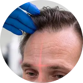 Consult a Hair Expert